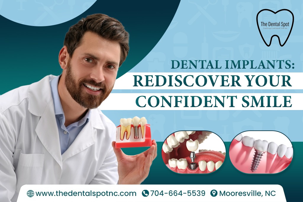 Dental Implants: Rediscover Your ConFident Smile