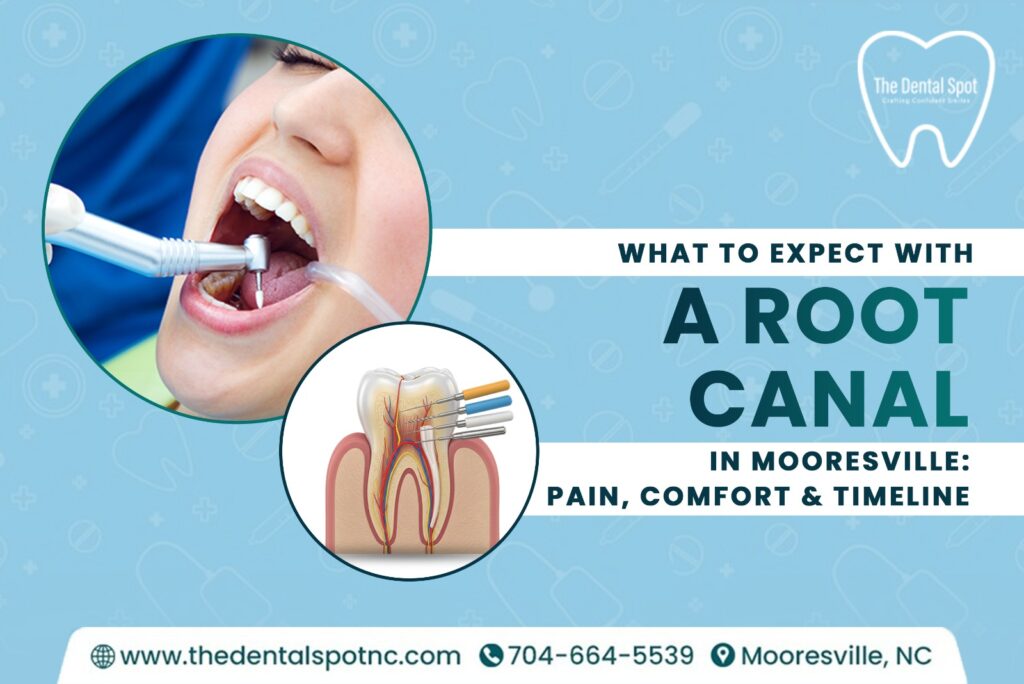 What to Expect With a Root Canal in Mooresville: Pain, Comfort & Timeline